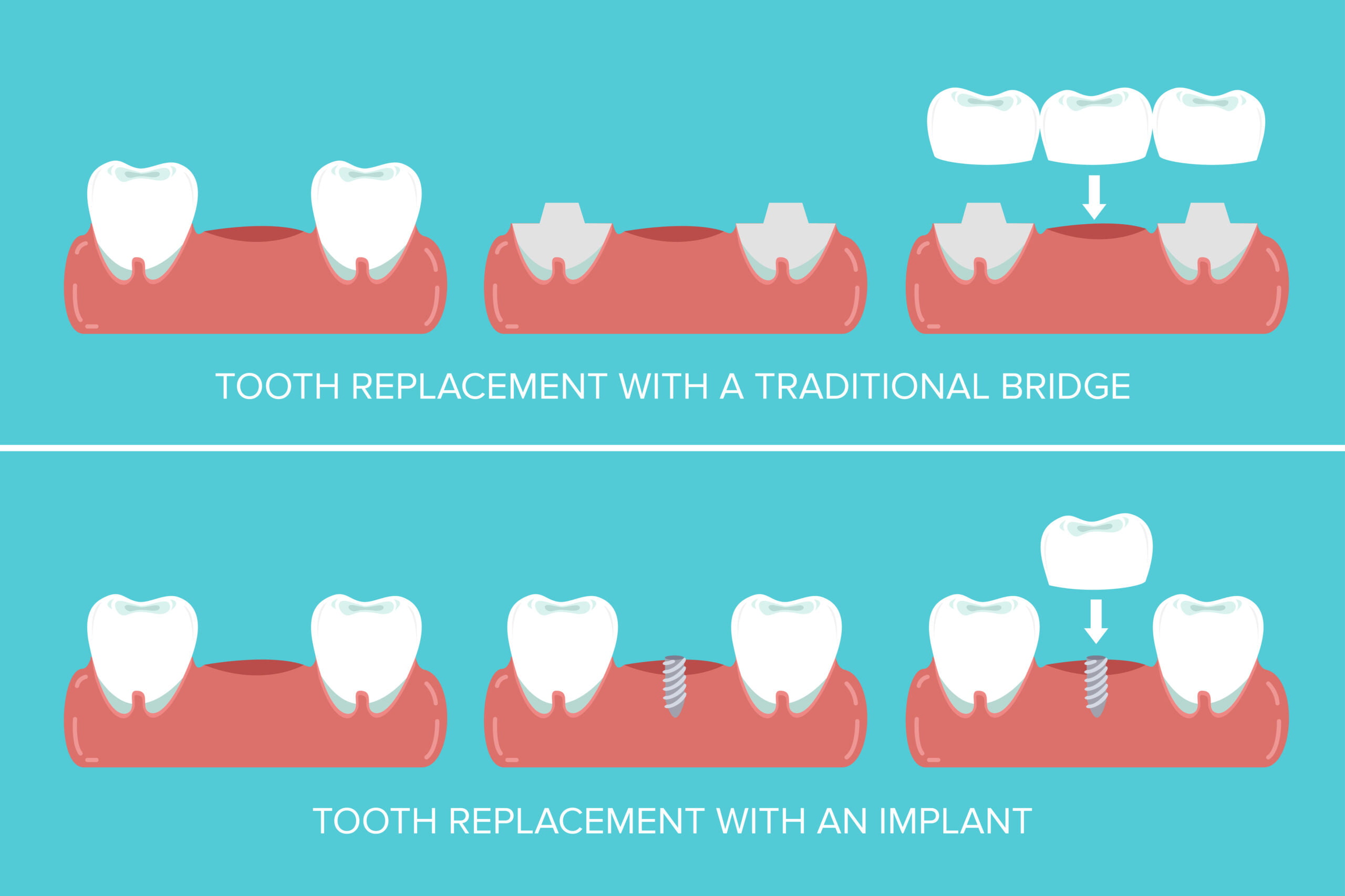 Dental Implants Strathroy