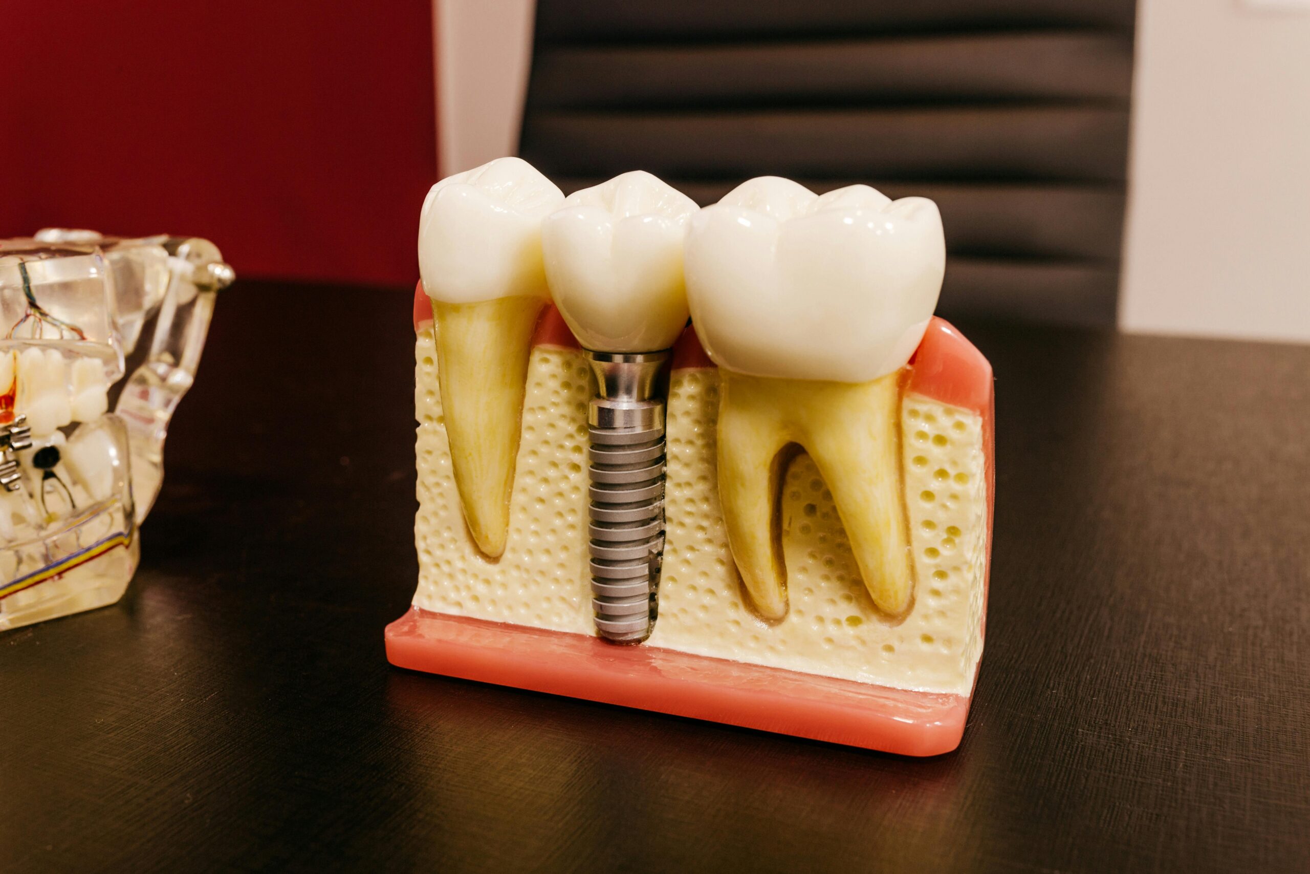 Dental Implants Strathroy