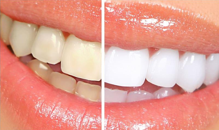 Dentist in Strathroy
